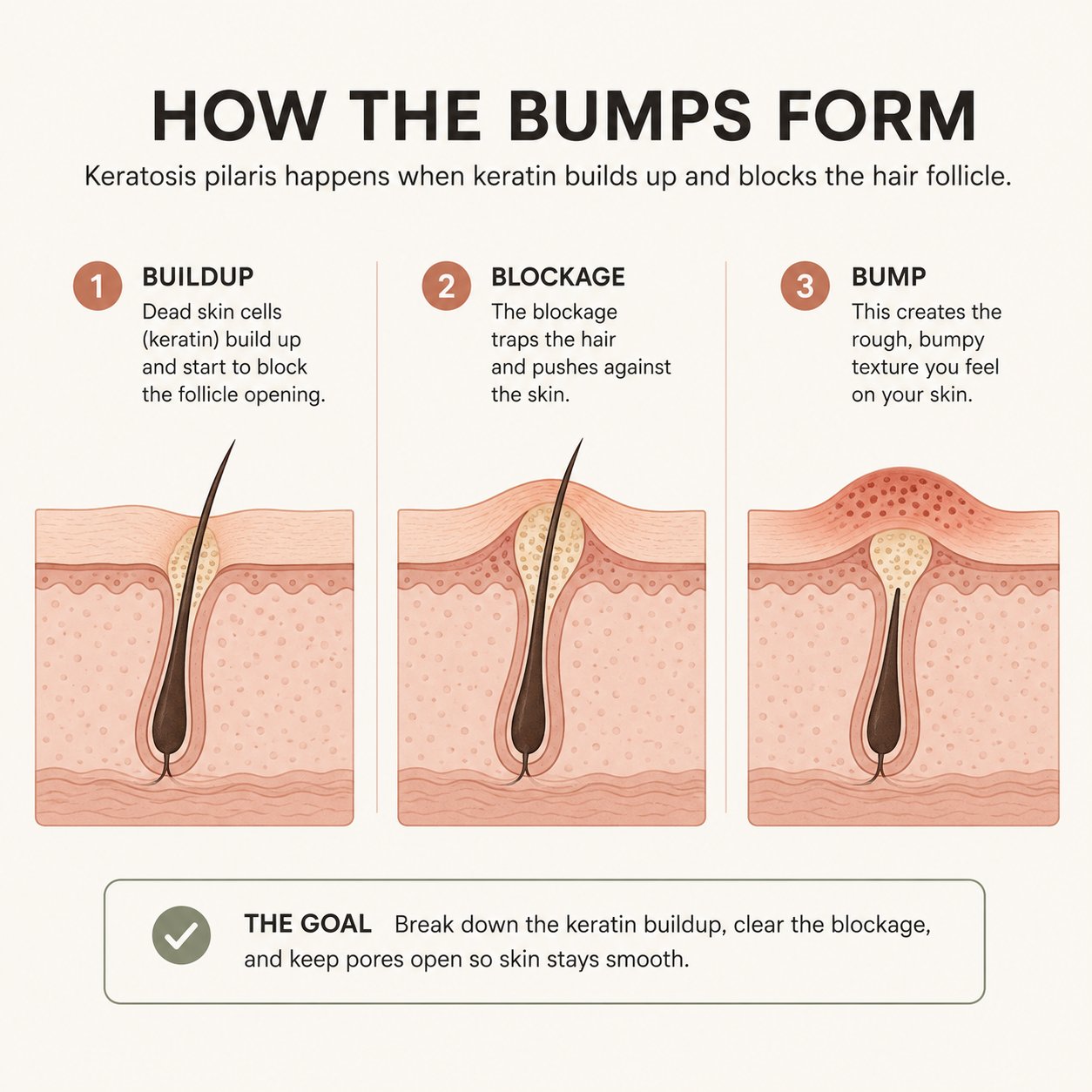 How the bumps form